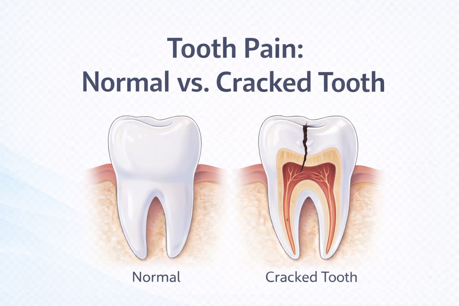 Cracked Tooth Pain: When It Becomes Urgent - Biocrede Endodontics
