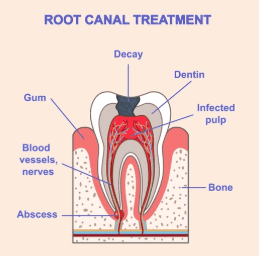 Does an Endodontist Pull Teeth? Role and Alternatives - Biocrede Endodontics
